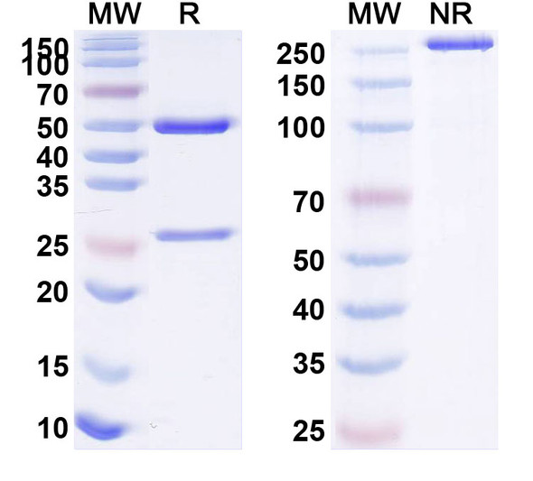 Human CD126/IL6R/IL-6RA (BOW070) Antibody - SDS-PAGE