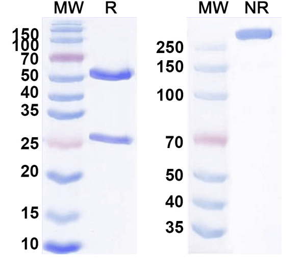 Human KAAG1 Antibody (AB-3A4) - SDS-PAGE