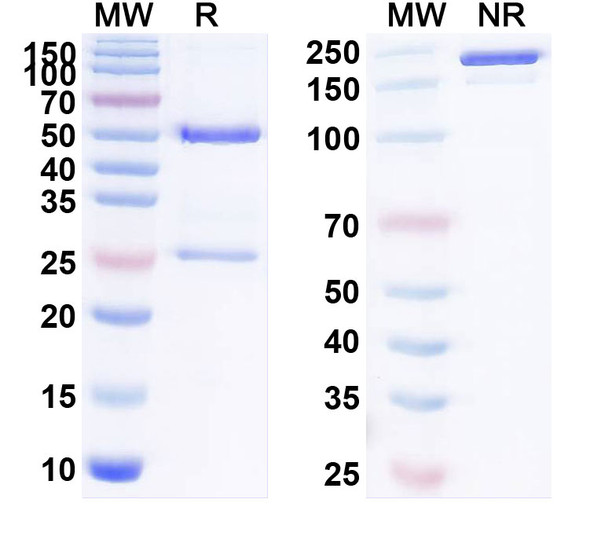 Human CD117/KIT (NN2101) Antibody - SDS-PAGE