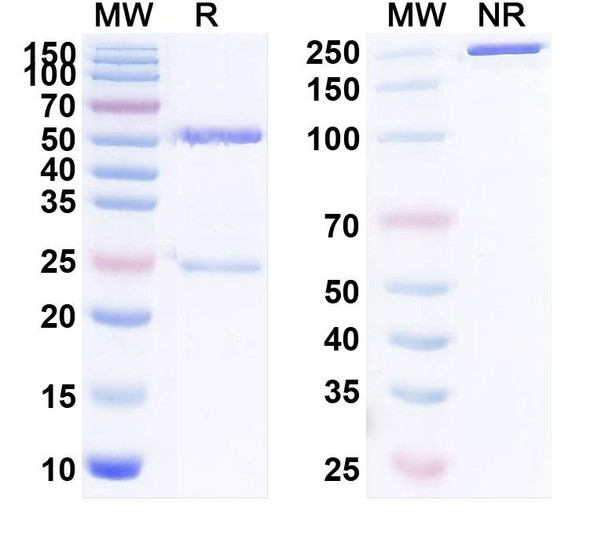 Human CD171/L1CAM (JCAR023) Antibody - SDS-PAGE