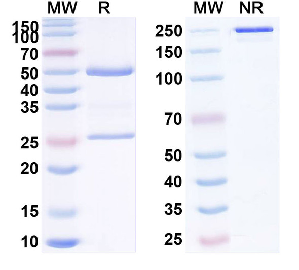 Human CD85d/LILRB2/ILT4 (ATG 032) Antibody - SDS-PAGE