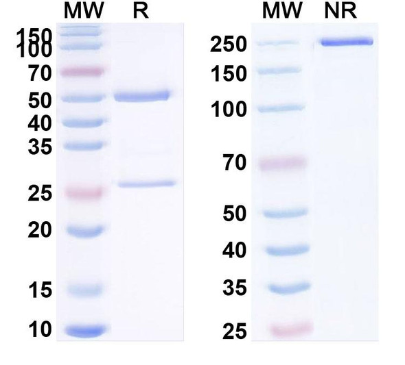 Human MASP2 (CM338) Antibody - SDS-PAGE