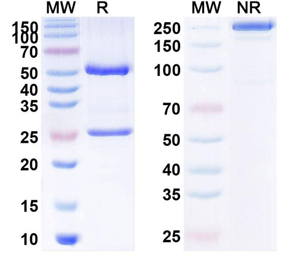 Human NECTIN4/PVRL4 (SBT6290) Antibody - SDS-PAGE
