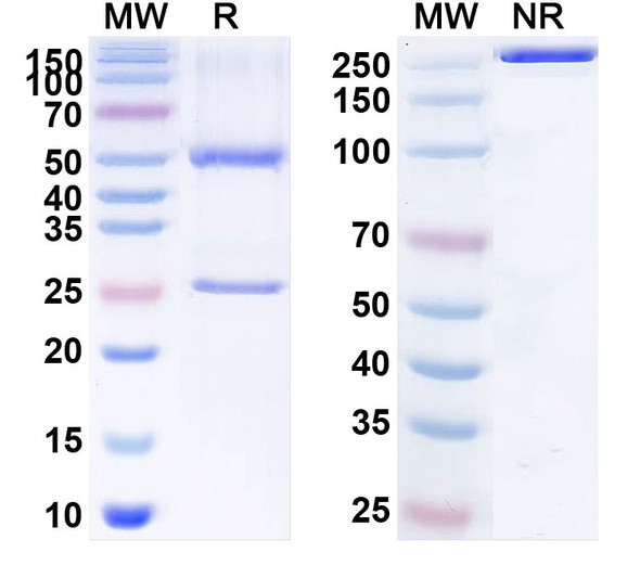 Human NRG1/Neuregulin-1 (JK07) Antibody - SDS-PAGE