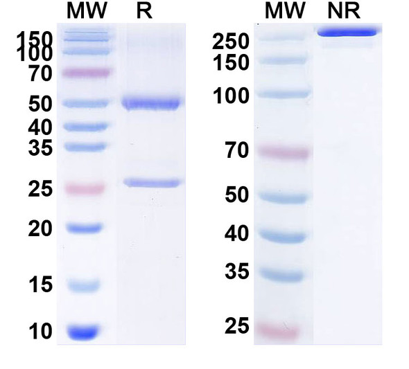 Human CD73/NT5E (JAB-BX102) Antibody - SDS-PAGE