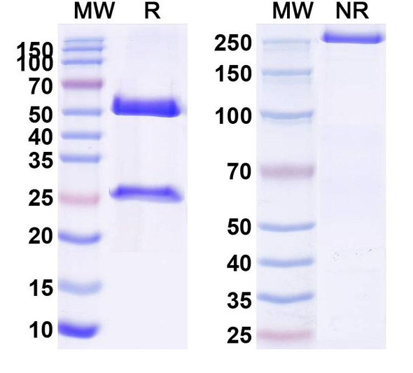 Human CDH3/P-cadherin (FF-21101) Antibody - SDS-PAGE