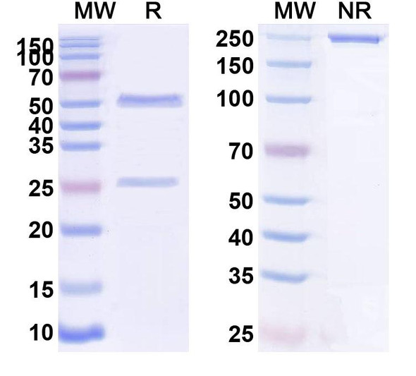 Human CDH3/P-cadherin (PCA062) Antibody - SDS-PAGE