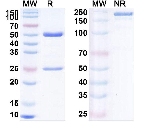 Human CD279/PDCD1/PD1 (LVGN3616) Antibody - SDS-PAGE