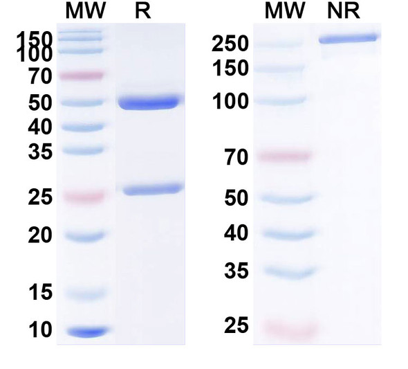 Human CD140b/PDGFRB (BOT1711) Antibody - SDS-PAGE