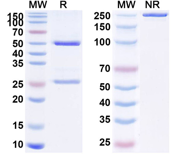Human PSCA (GEM 3 PSCA) Antibody - SDS-PAGE