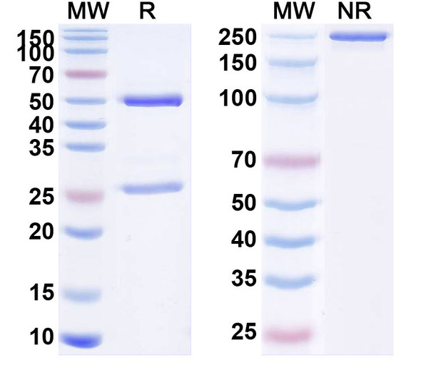 Human FOLH1/PSMA (ARX517) Antibody (ADC, Payload-Free) - SDS-PAGE
