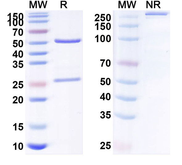 Human S100A4 (LK-1) Antibody - SDS-PAGE