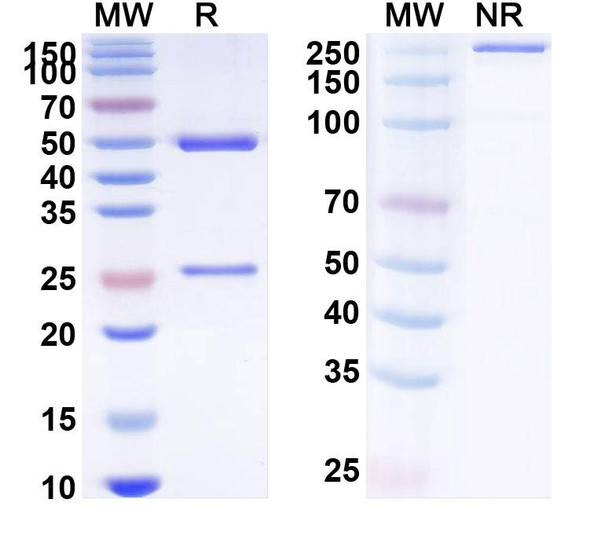 Anti-SARS-CoV-2 S protein (TY027) Antibody - SDS-PAGE