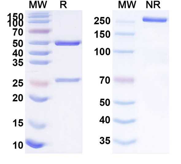 Human CD75/ST6GAL1 (EBU-141 Tetra) Antibody - SDS-PAGE