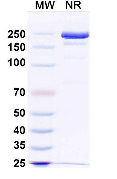 Human MAPT/Tau/PHF-tau (E2814) Antibody - SDS-PAGE