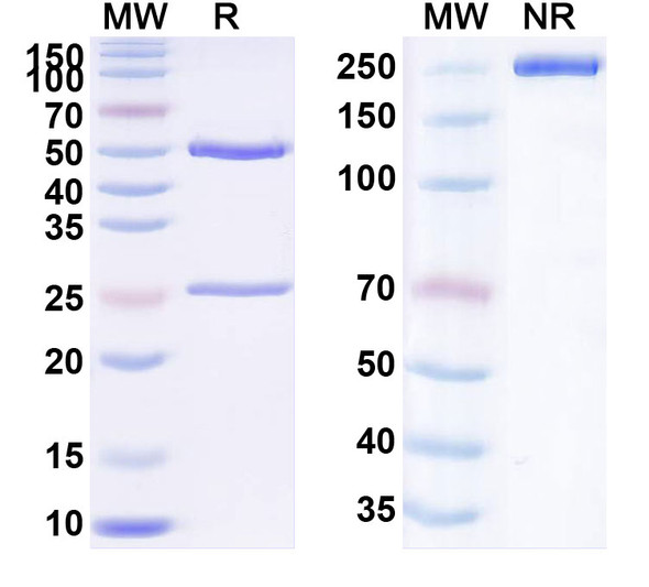 Human TIGIT (EOS-448) Antibody - SDS-PAGE