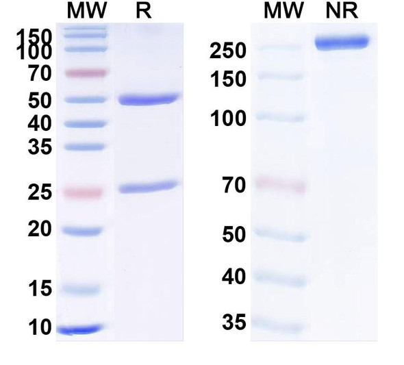 Human TNFa/TNF-alpha (CMAB008) Antibody - SDS-PAGE
