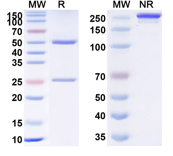 Human TNFa/TNF-alpha (TNF2) Antibody - SDS-PAGE