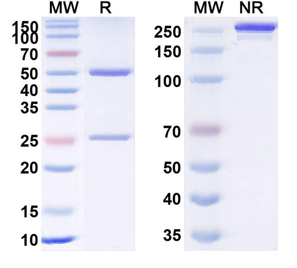 Human TNFa/TNF-alpha (TA_101) Antibody - SDS-PAGE