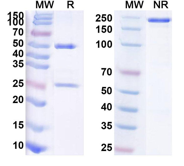 Human TPBG/5T4 (SYD 1875) Antibody (ADC, Payload-Free) - SDS-PAGE