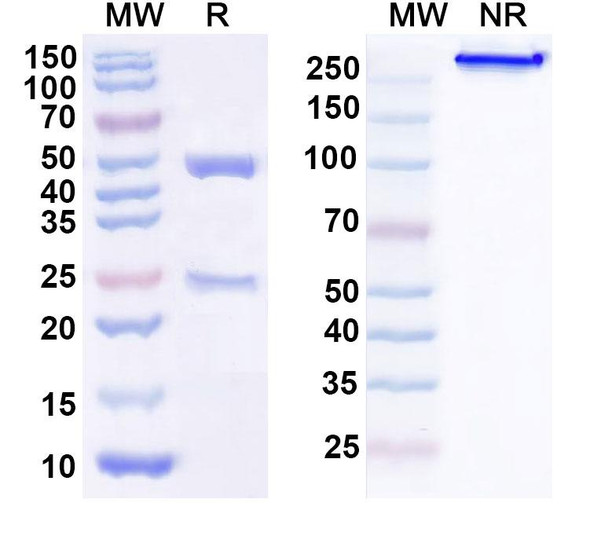 Human TSG101 (FGI-101-1A6) Antibody - SDS-PAGE