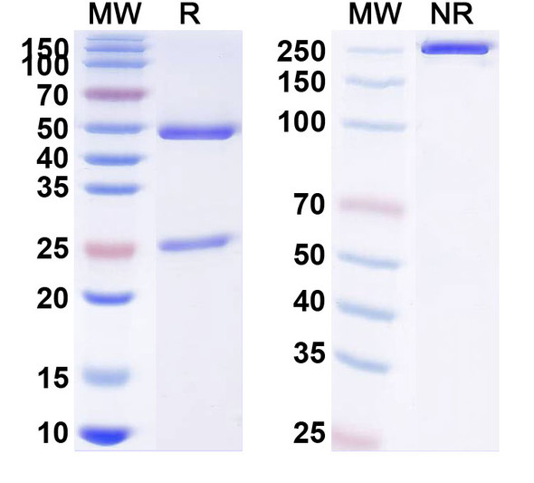 Human IL12B/IL-12 p40/NKSF2 (DF 6002) Antibody - SDS-PAGE