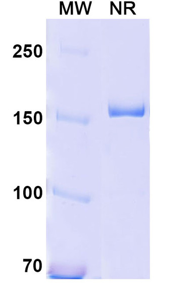 Human CD18/ITGB2 (YFC51.1) Antibody - SDS-PAGE
