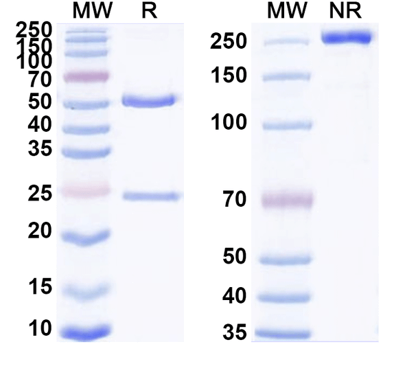 Human CDH6/Cadherin-6 (HKT288) Antibody (ADC, Payload-Free) - SDS-PAGE
