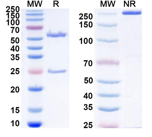 Human FOLH1/PSMA Antibody (MT112) - SDS-PAGE