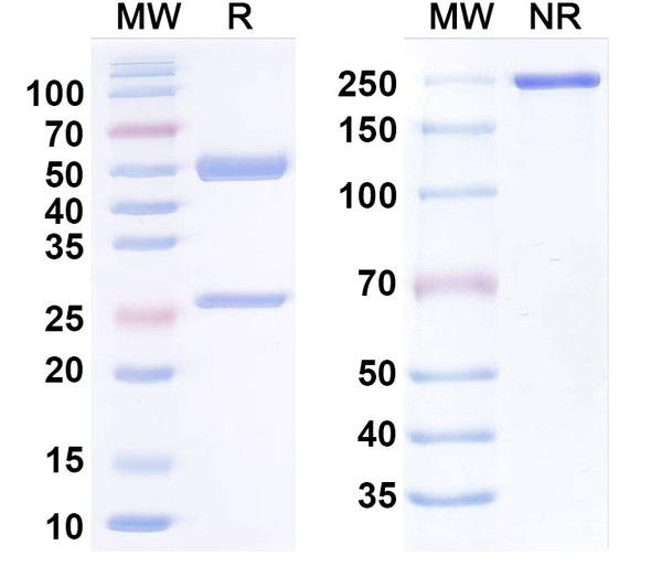 Anti-SARS-CoV-2 RBD Antibody (BG10-19) - SDS-PAGE