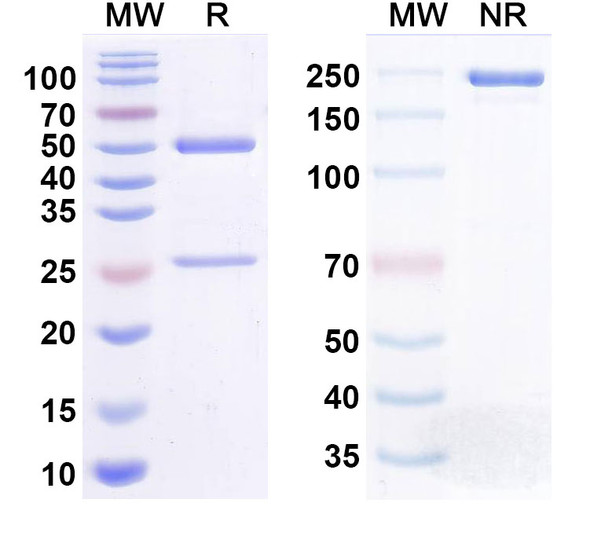 Human CD39/ENTPD1 Antibody (IPH5201) - SDS-PAGE