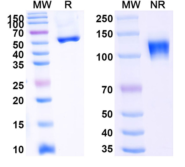 Ozekibart Antibody - SDS-PAGE