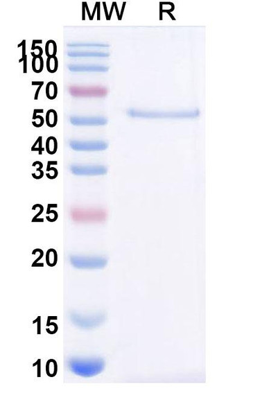Acimtamig Antibody - SDS-PAGE