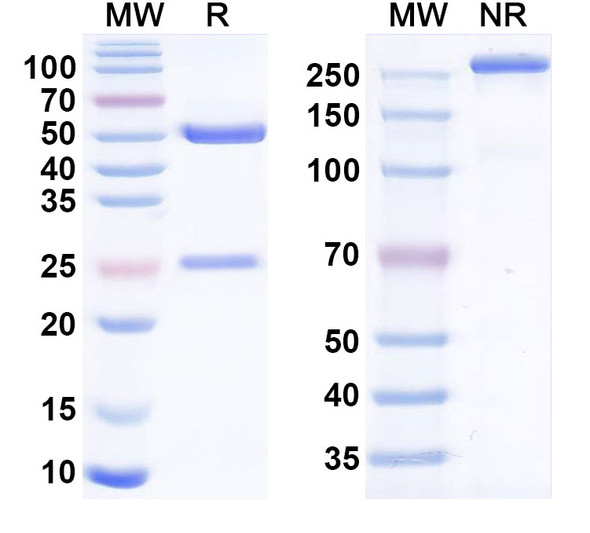Human ALPP/ALPPL2 Antibody (SGN-ALPV) (ADC, Payload-Free) - SDS-PAGE