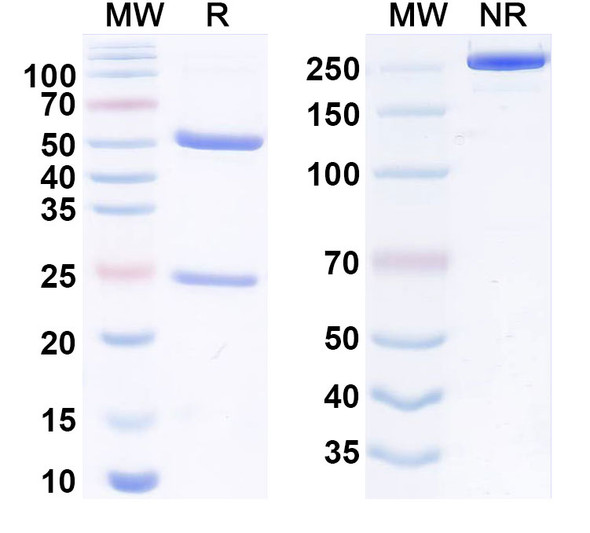 Human HLA-E Antibody (ABX-0020) - SDS-PAGE