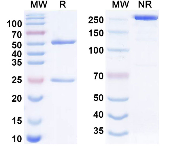 Human IL31 Antibody (mAb33) - SDS-PAGE