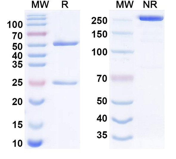 Human IL31 Antibody (mAb33) - SDS-PAGE