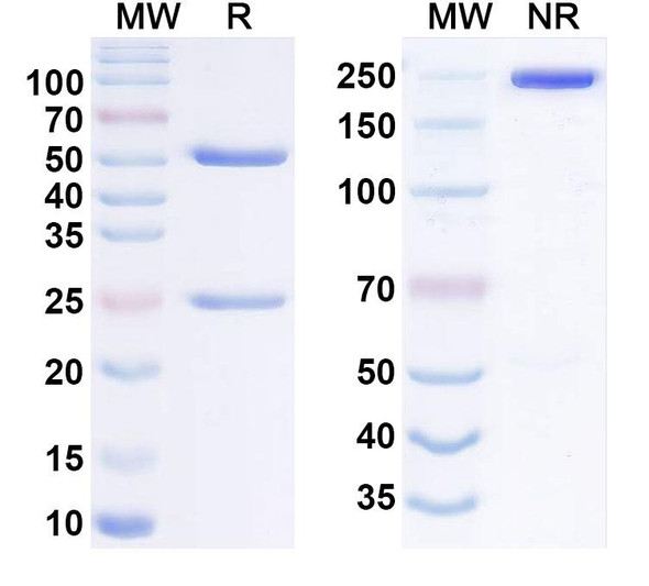 Human CD124/IL4R/IL-4Rα Antibody (12B5) - SDS-PAGE