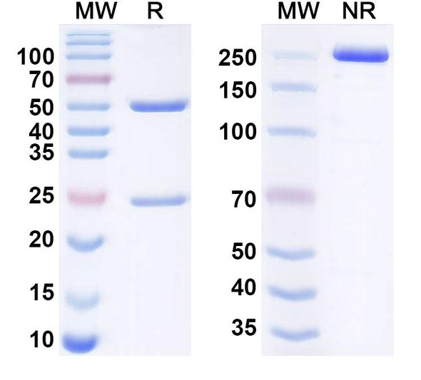 Nezastomig Antibody - SDS-PAGE