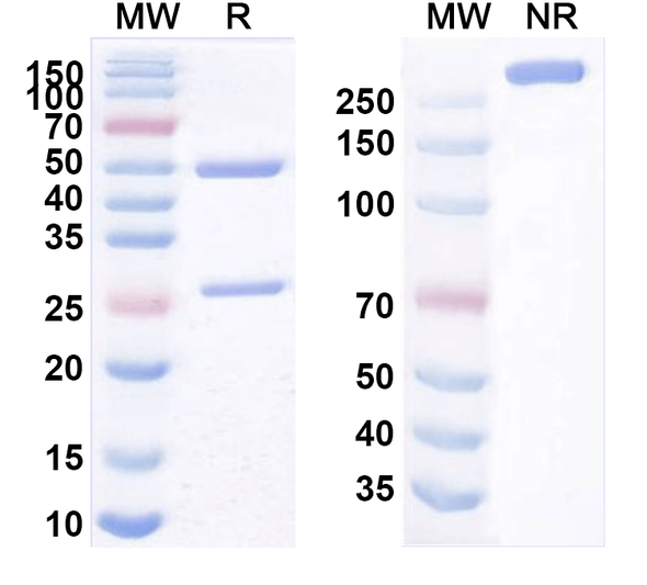 Verekitug Antibody - SDS-PAGE