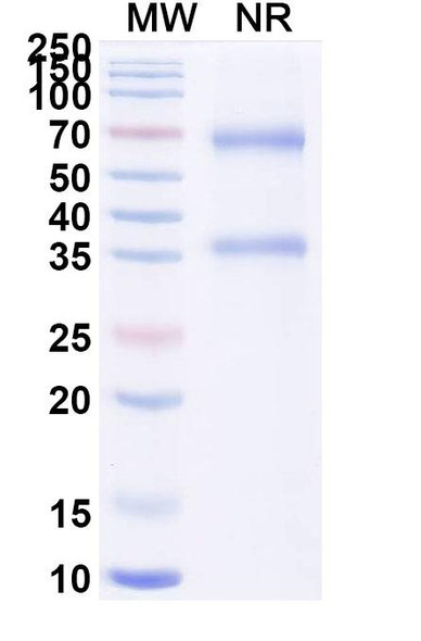 Alteplase (Research-Grade) - SDS-PAGE