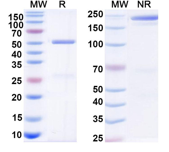 Anti-HBsAg Reference Antibody (OST 577) - SDS-PAGE