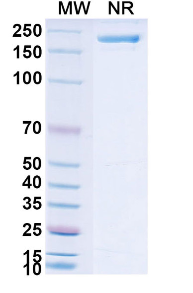 Neuradiab Antibody - SDS-PAGE