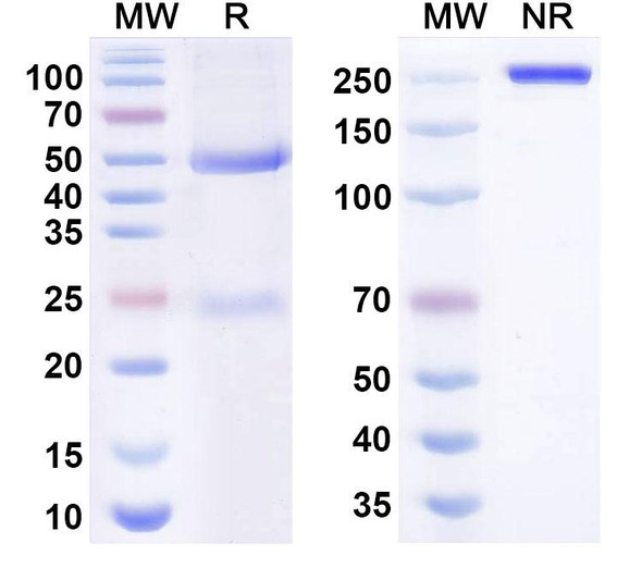 Human TSLP Antibody (GB-0895) - SDS-PAGE
