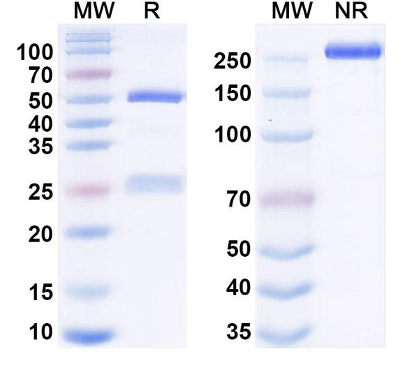 Human MMP14 Antibody (RLVT 14-02) - SDS-PAGE