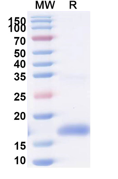 Anti-HIV1 gp120/Glycoprotein 120 Antibody (m36.4) - SDS-PAGE