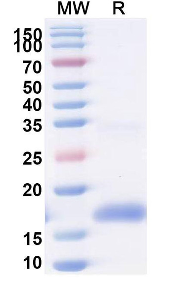 Anti-HIV1 gp120/Glycoprotein 120 Antibody (m36.4) - SDS-PAGE