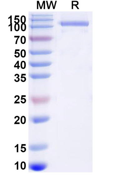 GAA/Aglucosidase Alfa (Research-Grade) - SDS-PAGE