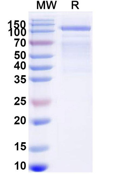 GAA/Aglucosidase Alfa (Research-Grade) - SDS-PAGE