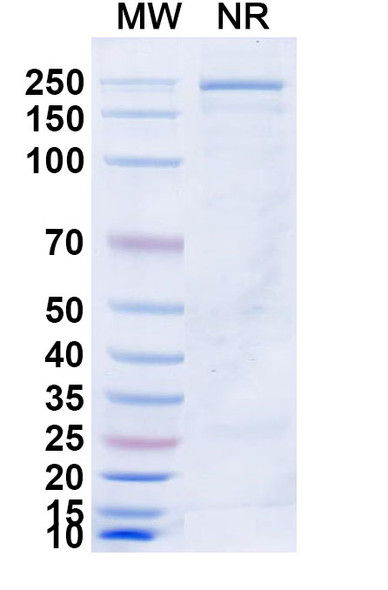 Azirkitug Antibody - SDS-PAGE